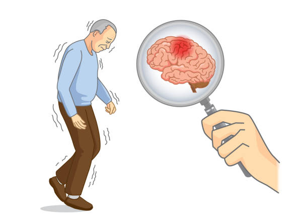 Animation explaining the assessment of Parkinson’s.